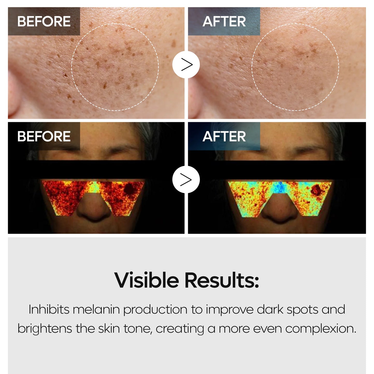 Dr.Melaxin TX Tranexamic Acid Dark Spot Care Line