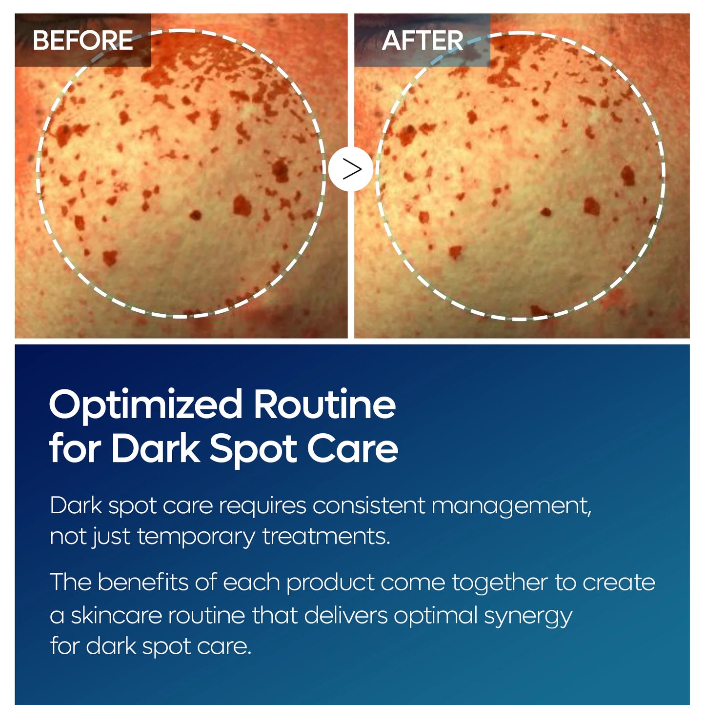 Dr.Melaxin TX Tranexamic Acid Dark Spot Care Line