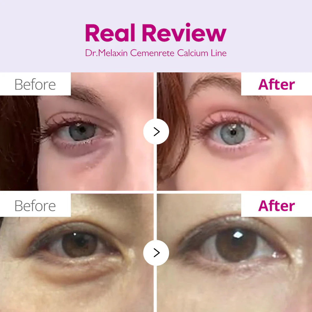 Dr.Melaxin Cemenrete Eye care Line