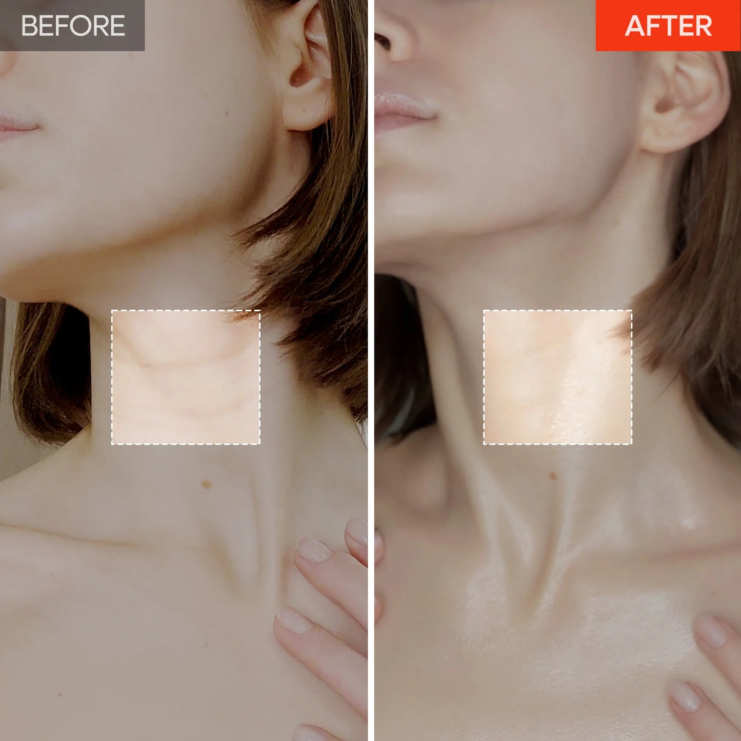 Dr.Melaxin 3-Minute Neck Wrinkle Care Trio