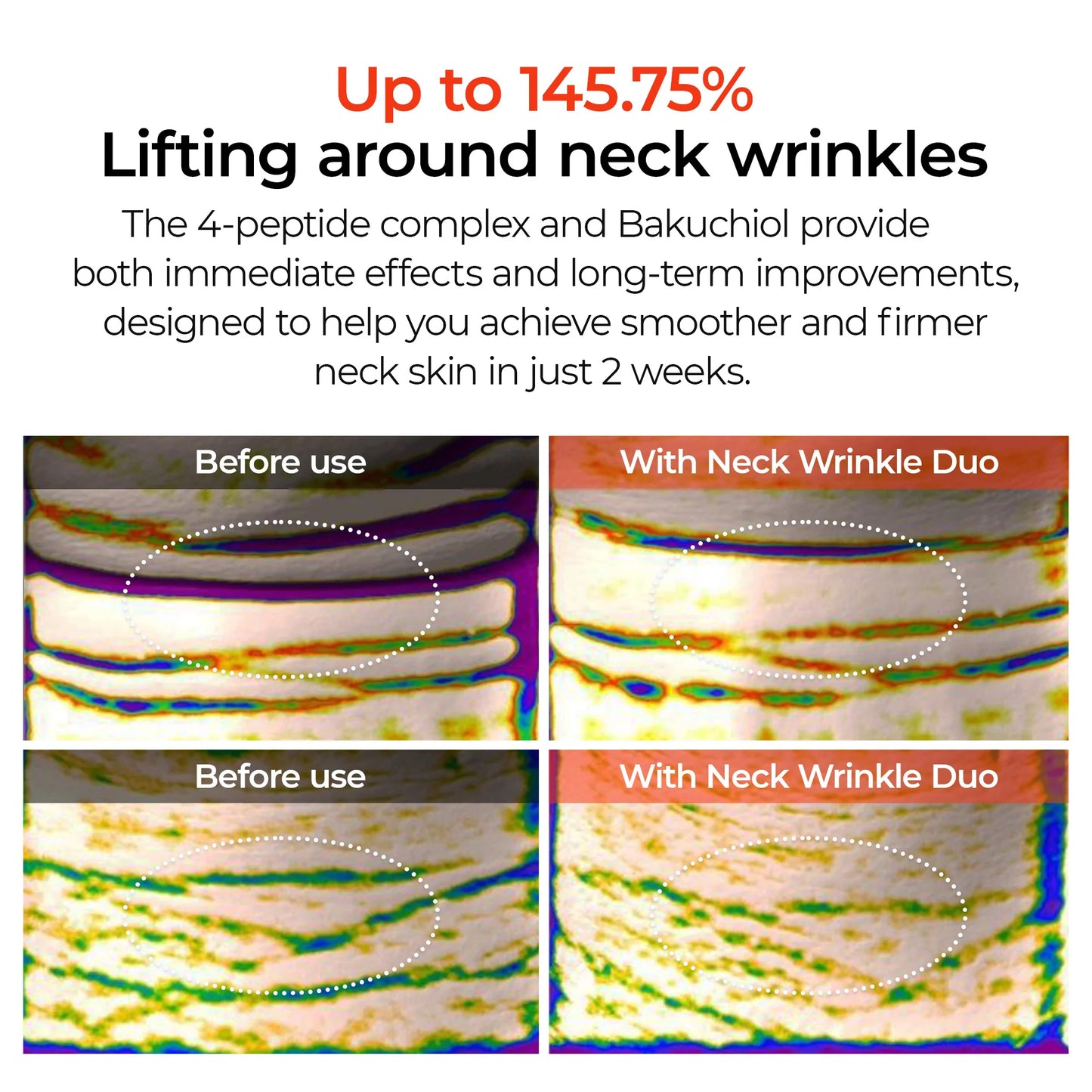 Dr.Melaxin 3-Minute Neck Wrinkle Care Trio
